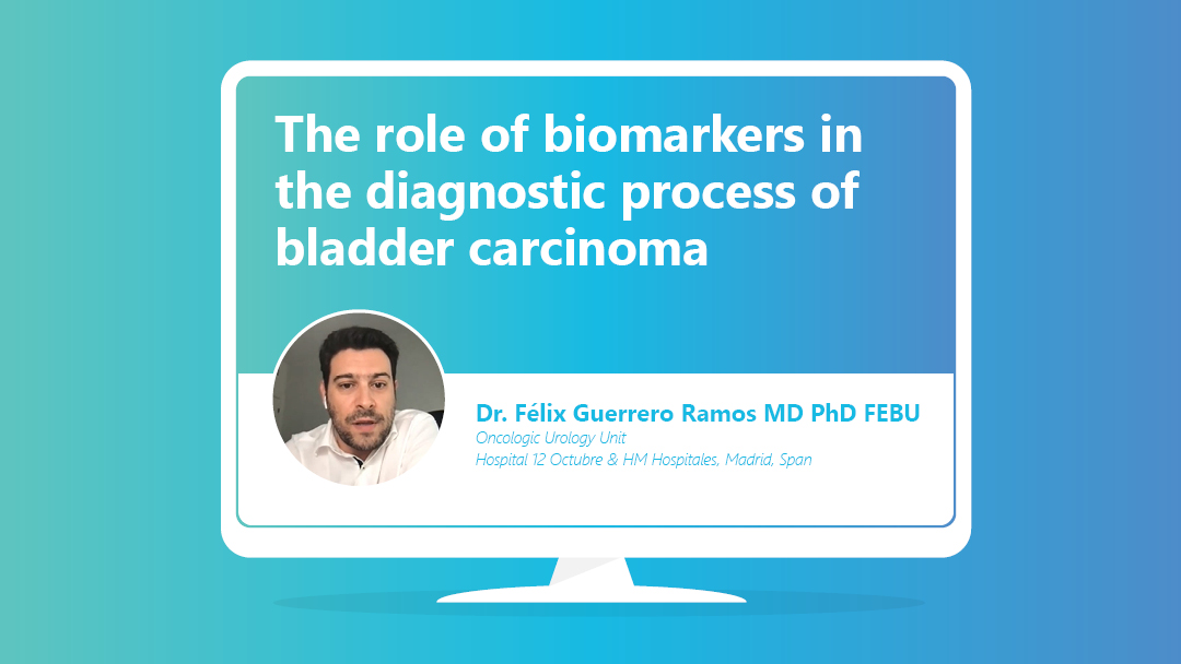 The role of biomarkers in the diagnostic process of bladder carcinoma