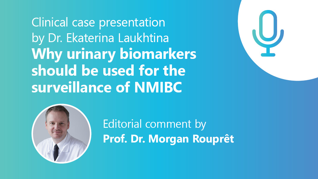 Why urinary biomarkers should be used for the surveillance of non-muscle-invasive bladder cancer