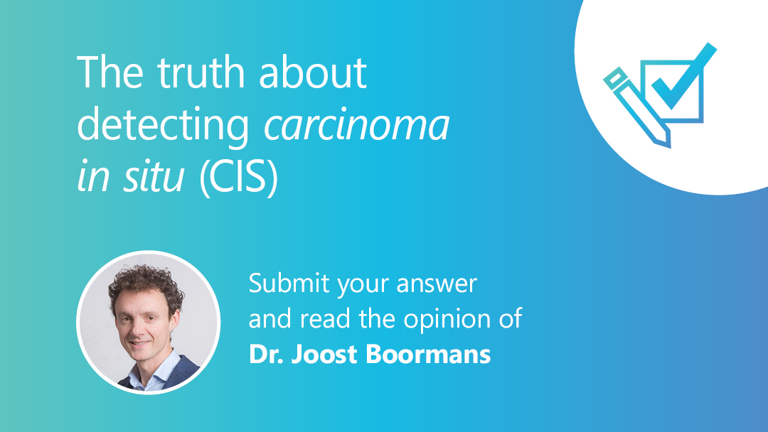 Compare your opinion with peers and Dr. Joost Boormans