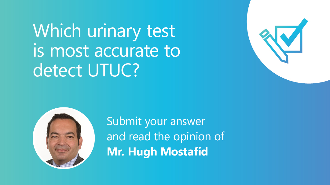 Compare your opinion with peers and Mr. Hugh Mostafid